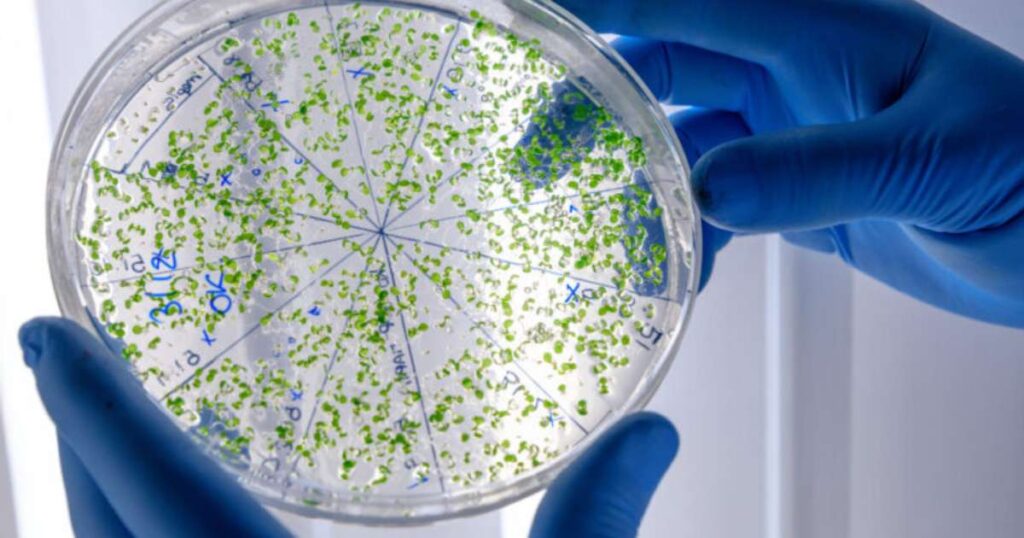 Hospital de Novo Hamburgo Fecha UTI Após Identificação de Superbactéria Imagem do artigo