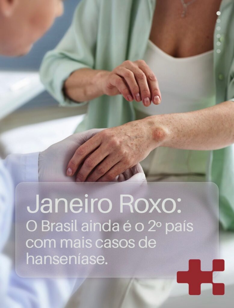 Janeiro Roxo: Alerta para Hanseníase e Importância do Diagnóstico Precoce