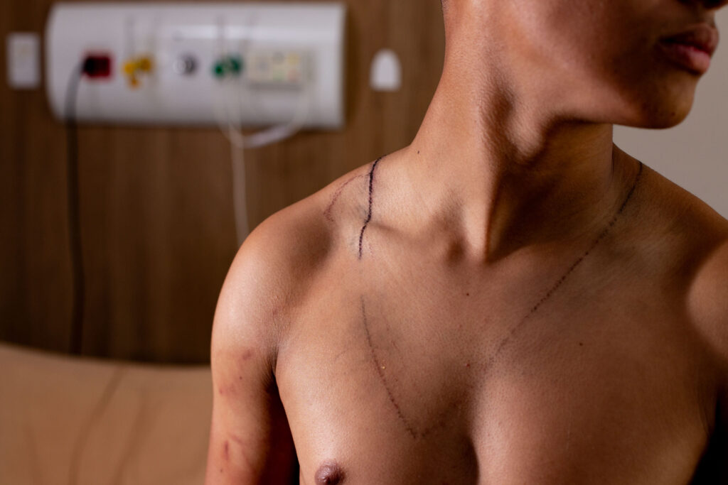 Jovem Atendido após Raio em Ato de Nikolas Ferreira: Um Relato de Superação