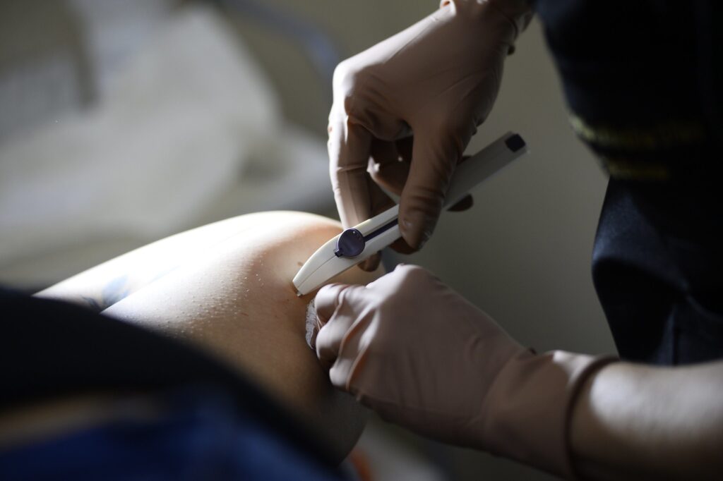 Novo Método Contraceptivo Implanon Disponível nas UBSs do DF