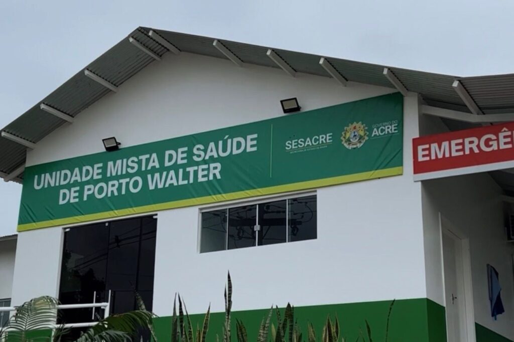 Avanço na Saúde Pública: Raio-X Modernizado em Porto Walter Aumenta Capacidade Diagnóstica Avanço na Saúde Pública: Raio-X Modernizado em Porto Walter Aumenta Capacidade Diagnóstica